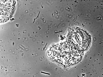 Spirochetes, rods, cocci