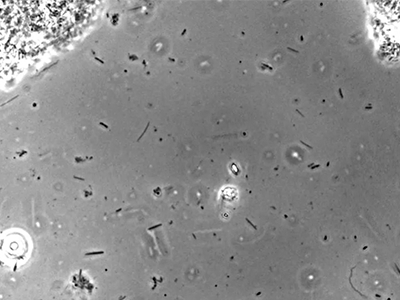 Spirochetes, rods, cocci